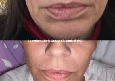 biorivitalizzazione vitamine ringiovanimento