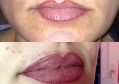 correzione labbra sbagliato da altrui