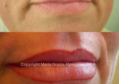 definizione contorno labbra