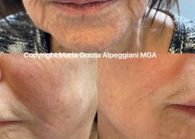 ringiovanimento vitamine