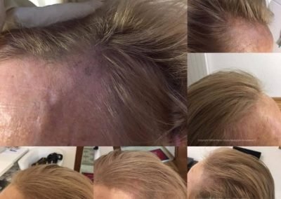 risoluzione di errore da altro operatore tempie cuoio capell donna-min