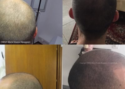 trico effetto densità-min