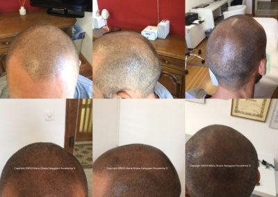 trico effetto rasato e densità-min