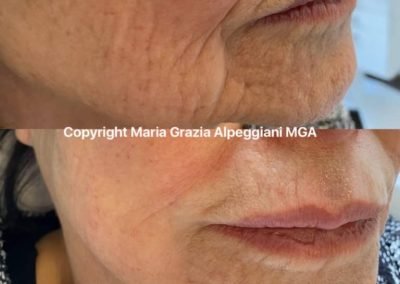 vitamine ringiovanimento