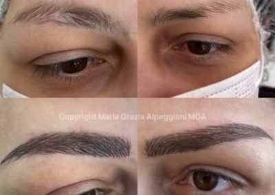 copert cicatrici sopracc