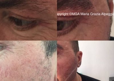 dermopigmentazione barba e sopracciglia