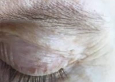 prima del microblading