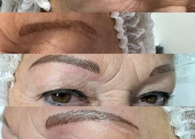 ricotr sopr donna pelo