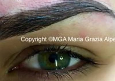 sopr dopo microblading