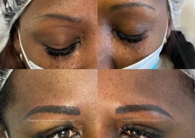 totale ricostr sopracc