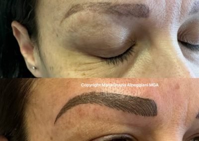 dermopigm estet corr sopracc