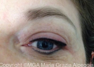 dopo b correzione solo della parte superiore