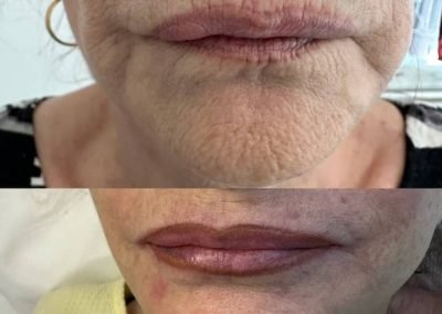 trucco permanente labbra